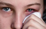 [ẢNH] Những loại bệnh dịch phổ biến do thời tiết ở Việt Nam